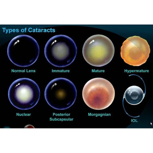 Lanomax Cataract Dissolving Lanosteral Eye Drops for Dogs Cats